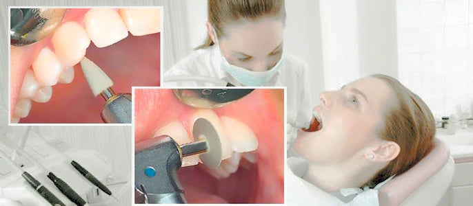 Dental Silicone Grinding Head Amalgam/Metal Polisher For Low-Speed Handpiece Contra angle Composite Teeth Polishing RA Stone