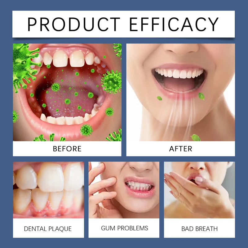 Coconut Oil Pulling Mouthwash With Mint Tongue Scraper Alcohol Free Teeth Whitening Oral Rinse Non-greasy For Fresh Breath Healthy Gum Soothing Gums Natural Fluoride Free Anti Plaque Clean Mouth Wash Vegan Travel Size New