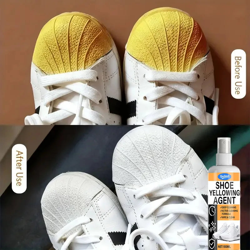Shoe Yellowing Removal - Shoes Hair Yellow, Sole, Sneakers, Canvas Shoes, Shoes Turning Yellow, Shoe Care, Removing Yellow,100ml