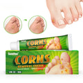 Foot Corn Remover Cream Chicken Eye Skin Infection Treatment Ointment Feet Dead Skin Calluses Removal Tool Beauty-health