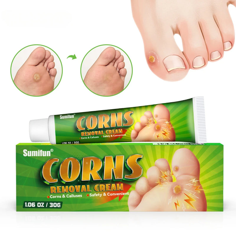 Foot Corn Remover Cream Chicken Eye Skin Infection Treatment Ointment Feet Dead Skin Calluses Removal Tool Beauty-health