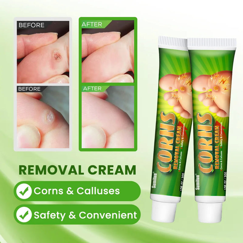 Foot Corn Remover Cream Chicken Eye Skin Infection Treatment Ointment Feet Dead Skin Calluses Removal Tool Beauty-health
