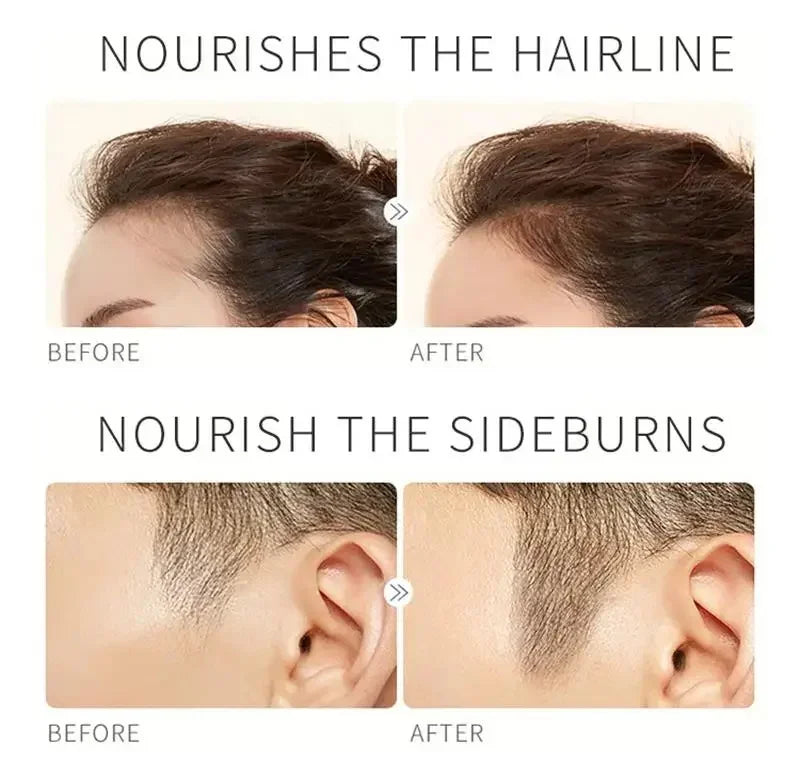 Fast Eyelash Growth Serum Eyebrow Hair Growth Anti Hairs Loss Product Prevent Baldness Fuller Thicker Lengthening Eyebrow Makeup