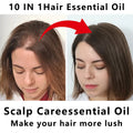 10-in-1 Castor Hair Essential Oil 100ml - Nourishing Scalp Oil with Batana, Peppermint & Biotin