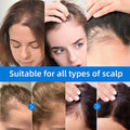 Seapuri Scalphy Hair Essence Rollerball Nourishing Anti-Frizz Hair Serum  Refreshing Strengthening Hair Essence Scalp Treatment
