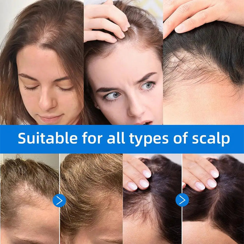 Seapuri Scalphy Hair Essence Rollerball Nourishing Anti-Frizz Hair Serum  Refreshing Strengthening Hair Essence Scalp Treatment