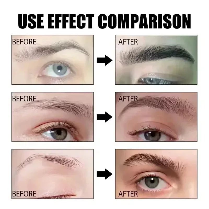 Fast Eyelash Growth Serum Eyebrow Hair Growth Anti Hairs Loss Product Prevent Baldness Fuller Thicker Lengthening Eyebrow Makeup