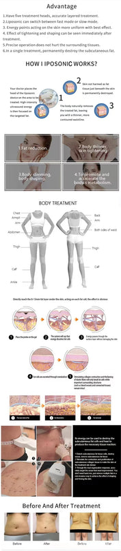 2025 Professional Portable Liposonix Body Sculpting Machine for Slimming Weight Loss Anti Aging Skin Tightening