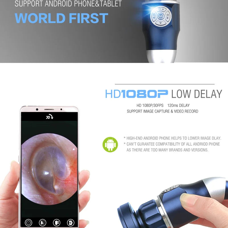 Portable 1080P Endoscope Camera, HDMI/USB Dual Mode for ENT/Arthroscopy/Veterinary Surgery, Support Android/PC/Monitor