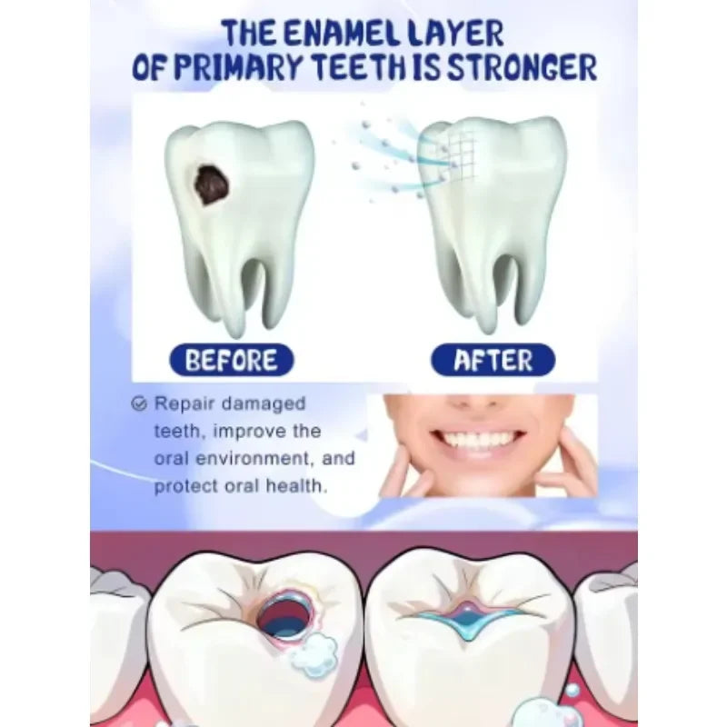 2026 Best-Selling Oral Care Tooth Cleaner: Probiotic Formula for Inhibiting Harmful Tooth Growth & Boosting Oral Hygiene