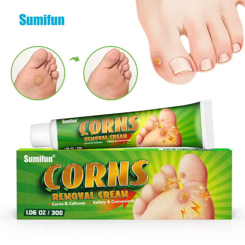 Foot Corn Remover Cream Chicken Eye Skin Infection Treatment Ointment Feet Dead Skin Calluses Removal Tool Beauty-health