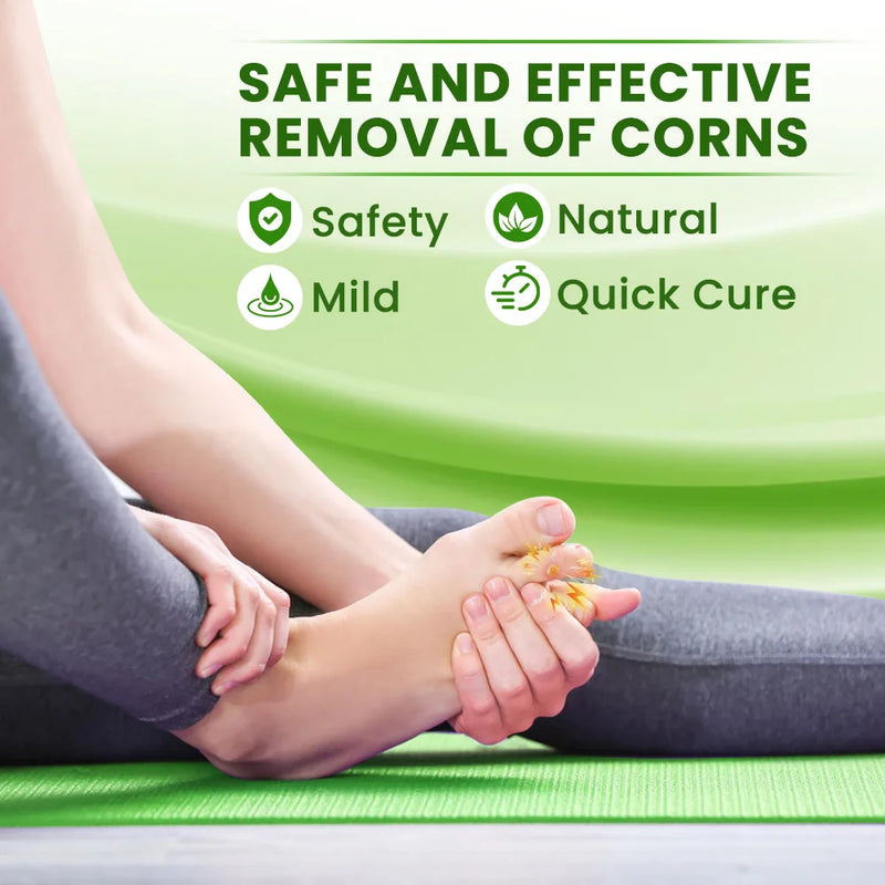 Foot Corn Remover Cream Chicken Eye Skin Infection Treatment Ointment Feet Dead Skin Calluses Removal Tool Beauty-health