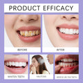 Purple Mouthwash Fresh Mint Flavor Gentle Formula Daily Oral Care Portable 20 Sachets Travel Size No Alcohol Quick Rinse 240ml