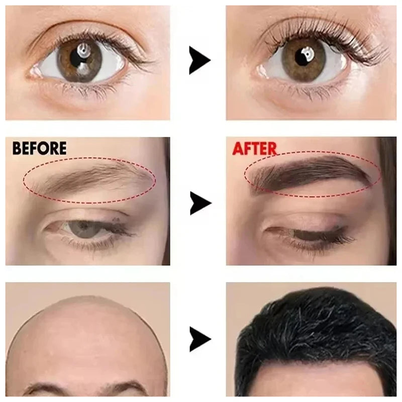 Fast Eyelash Growth Serum Eyebrow Hair Growth Anti Hairs Loss Product Prevent Baldness Fuller Thicker Lengthening Eyebrow Makeup