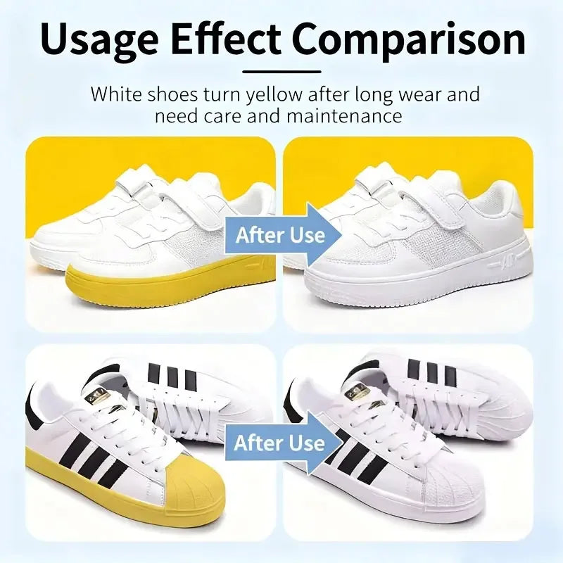 Shoe Yellowing Removal - Shoes Hair Yellow, Sole, Sneakers, Canvas Shoes, Shoes Turning Yellow, Shoe Care, Removing Yellow,100ml