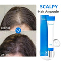 Seapuri Scalphy Hair Essence Rollerball Nourishing Anti-Frizz Hair Serum  Refreshing Strengthening Hair Essence Scalp Treatment