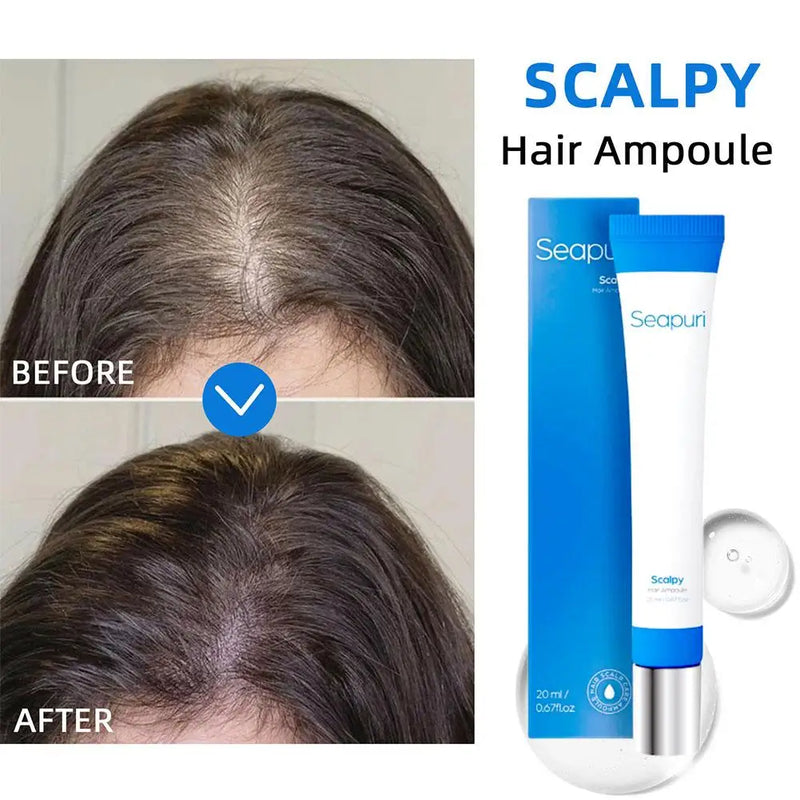 Seapuri Scalphy Hair Essence Rollerball Nourishing Anti-Frizz Hair Serum  Refreshing Strengthening Hair Essence Scalp Treatment