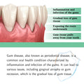 Gingival Repair Drops Quickly Repair of Cavities Caries Teeth Whiten Remove Yellow Plaque Stains Relieve Gums Decay Toothpaste