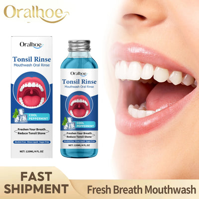 Oral Fresh Mouthwash Remove Mouth Odor Reduce Tonsil | SAMAG