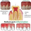50ML Damaged Gum RepairCare Gel Serum Relieve Sore Gums Allergy Deep Cleaning Teeth Stains Tartar Serum Dental Caries Toothpaste