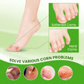 Foot Corn Remover Cream Chicken Eye Skin Infection Treatment Ointment Feet Dead Skin Calluses Removal Tool Beauty-health