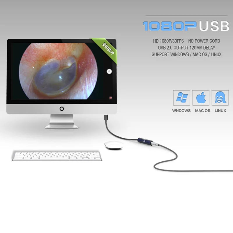 Portable 1080P Endoscope Camera, HDMI/USB Dual Mode for ENT/Arthroscopy/Veterinary Surgery, Support Android/PC/Monitor
